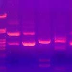 Electrophoresis